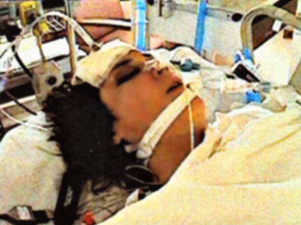 Janet Kuypers photographed unconscious in the hospital after a July 11 1998 car accident