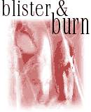 blister and burn