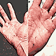bloodied hands